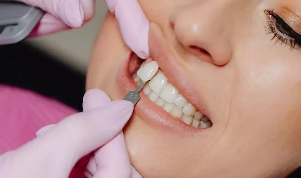 Cosmetic dental